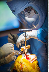 Reportage_206 / Orthopädische Operation  ORTHOPEDIC SURGERY