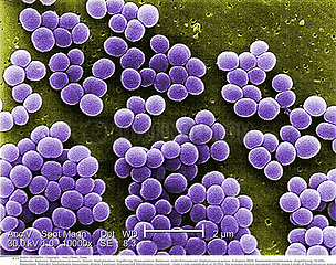 Staphylococcus aureus bacteria Imagerie