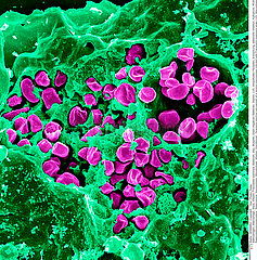 Macrophage with Francisella tularensis Imagerie