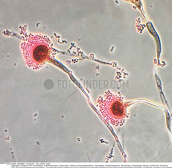 Aspergillus fumigatus Imagerie
