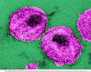 HIV virus particles Imagerie