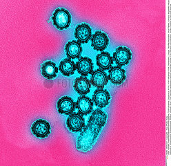H1N1 virus particles