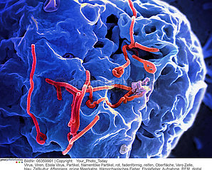 Ebola Virus Imagerie
