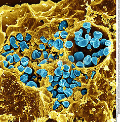 Macrophage with Francisella tularensis Imagerie