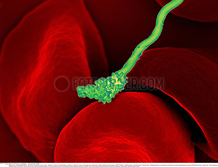 Human blood cells with Borrelia hermsii