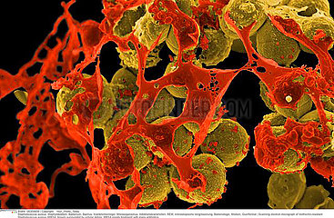 Methicillin-resistant Staphylococcus aureus Imagerie