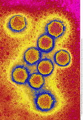 HEPATITIS A VIRUS