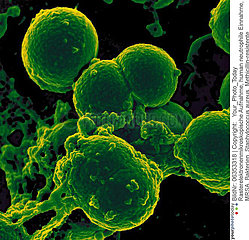 Neutrophil and Methicillin-resistant Staphylococccus aureus (MRSA) Bacteria