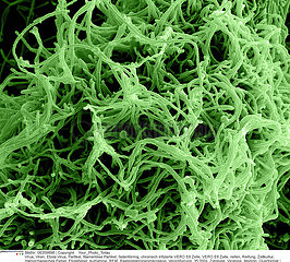 Ebola Virus Particles Imagerie