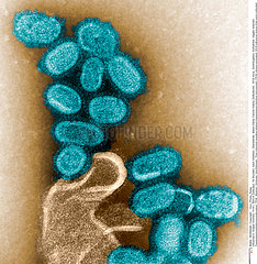 SPANISH FLU VIRUS Imagerie