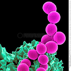 White blood cell and MRSA Imagerie