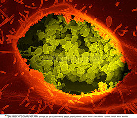 Coxiella burnetii  the bacteria that causes Q Fever