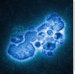 INFLUENZA A H7N9 VIRUS Imagerie