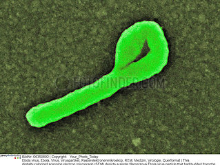 Ebola virus Imagerie