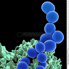 White blood cell and MRSA Imagerie