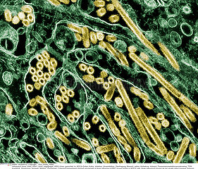 AVIAN INFLUENZA INFECTION Imagerie