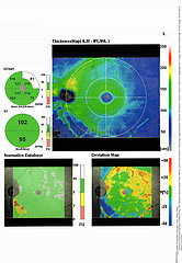 OPTICAL COHERENCE TOMOGRAPHY