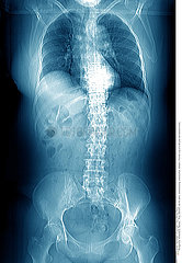 TRUNK X-RAY