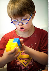 CHILD  DOWN'S SYNDROME Reportage