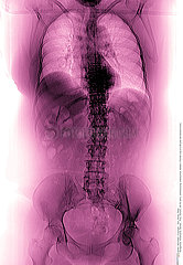 TRUNK X-RAY