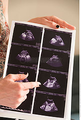 PREGNANT WOMAN  ULTRASONOGRAPHY