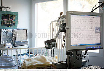 A premature baby is constantly watched with probes and sensors in the neonatalogy department.