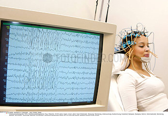 EPILEPSY  EEG