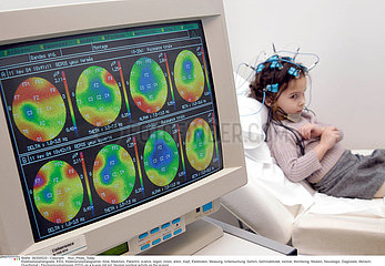EEG EXAMINATION OF A CHILD