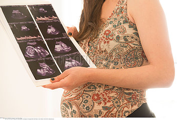 PREGNANT WOMAN  ULTRASONOGRAPHY