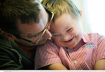 CHILD  DOWN'S SYNDROME Reportage