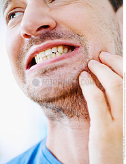 MAN WITH TOOTHACHE