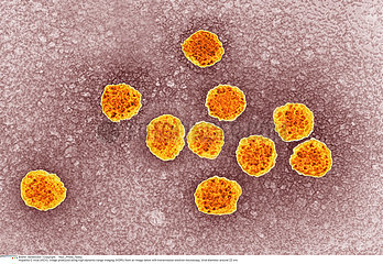 HEPATITIS C VIRUS