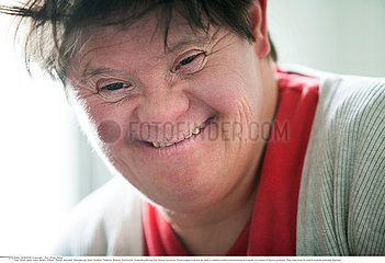 ADULT  DOWN'S SYNDROME Reportage