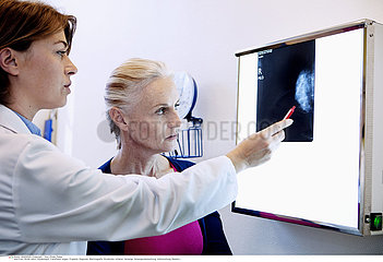 MAMMOGRAPHY RESULT