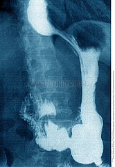 STOMACH  X-RAY