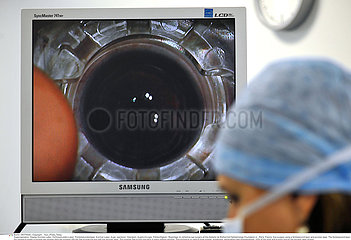 Augenlaser-Operation Fehlsichtigkeit / EYE LASER SURGERY
