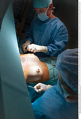 PLASTIC SURGERY ON A BREAST