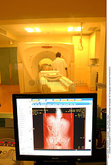 Kidney scan