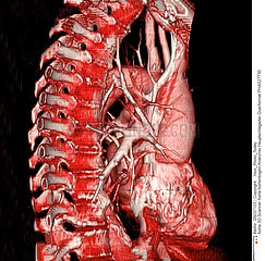 Aortic arch