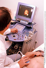 3D ultrasound scan