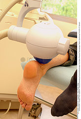 Shock wave therapy