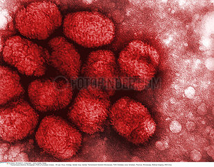 Smallpox virus