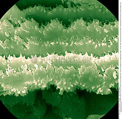 Crystalline lens cells