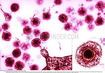 Human herpes virus-6