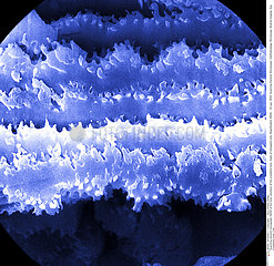Crystalline lens cells