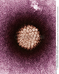 Human papilloma virus
