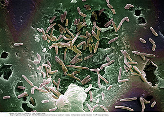 Mycobacterium chelonae