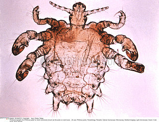 Crab louse
