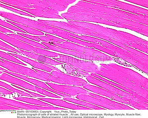 Striated muscle