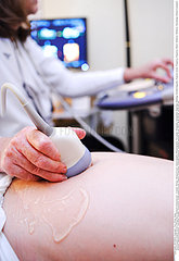 Foetal ultrasound scan
